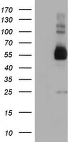 TULP3 Monoclonal Antibody (OTI6D8), TrueMAB , OriGene:Antibodies:Primary