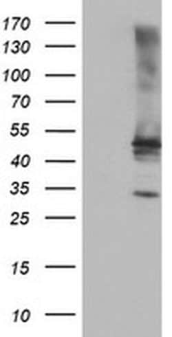 TULP3 Monoclonal Antibody (OTI6C7), TrueMAB , OriGene 100 &mu;L; Unconjugated:Antibodies,