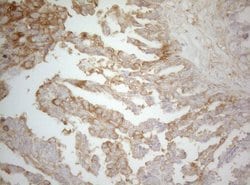 TWF1 Monoclonal Antibody (OTI5C12), TrueMAB , OriGene 100 &mu;L; Unconjugated:Antibodies,