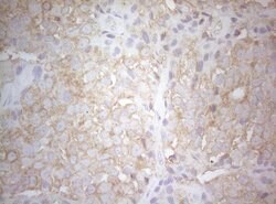 TWF1 Monoclonal Antibody (OTI5C12), TrueMAB , OriGene 100 &mu;L; Unconjugated:Antibodies,