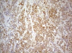 TWF1 Monoclonal Antibody (OTI5C12), TrueMAB , OriGene:Antibodies:Primary
