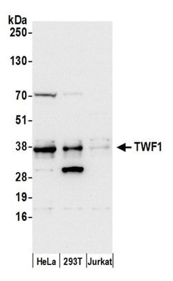 TWF1/PTK9 Polyclonal Antibody, Bethyl Laboratories:Antibodies:Primary Antibodies