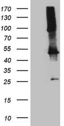 TWF1 Monoclonal Antibody (OTI6C11), TrueMAB , OriGene:Antibodies:Primary