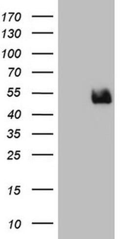 TWF1 Monoclonal Antibody (OTI10E6), TrueMAB , OriGene:Antibodies:Primary
