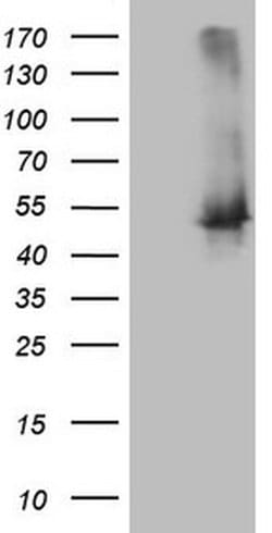 TWF1 Monoclonal Antibody (OTI5C11), TrueMAB , OriGene:Antibodies:Primary