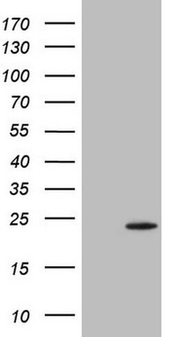 TWIST2 Monoclonal Antibody (OTI6G9), TrueMAB , OriGene:Antibodies:Primary