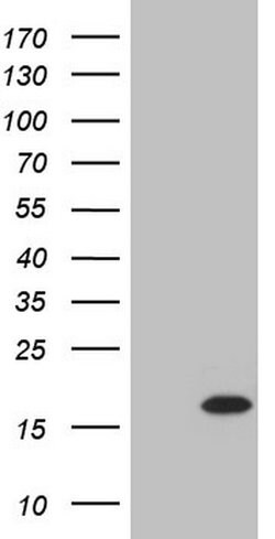 TWIST2 Monoclonal Antibody (OTI9F11), TrueMAB , OriGene 100 &mu;L; Unconjugated:Antibodies,