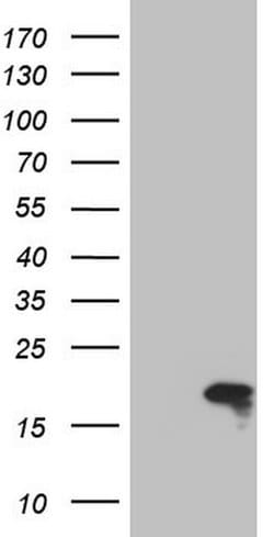 TWIST2 Monoclonal Antibody (OTI1C4), TrueMAB , OriGene 100 &mu;L; Unconjugated:Antibodies,