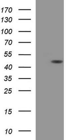 TXNDC5 Monoclonal Antibody (OTI1E2), TrueMAB , OriGene 100 &mu;L; Unconjugated:Antibodies,