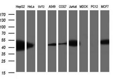 TXNDC5 Monoclonal Antibody (OTI1E2), TrueMAB , OriGene 100 &mu;L; Unconjugated:Antibodies,