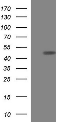 TXNDC5 Monoclonal Antibody (OTI1D4), TrueMAB , OriGene 30 &mu;L | Buy Online | Origene Technologies | Fisher Scientific