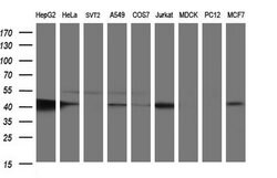 TXNDC5 Monoclonal Antibody (OTI1D4), TrueMAB , OriGene 30 &mu;L | Buy Online | Origene Technologies | Fisher Scientific