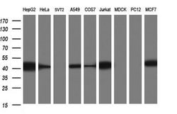 TXNDC5 Monoclonal Antibody (OTI1F6), TrueMAB , OriGene 100 &mu;L; Unconjugated:Antibodies,