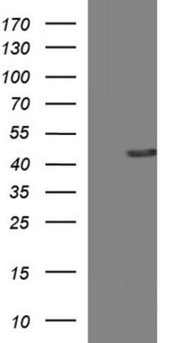 TXNDC5 Mouse anti-Human, Mouse, Clone: OTI1C3, lyophilized, TrueMAB 100