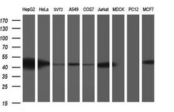 TXNDC5 Mouse anti-Human, Mouse, Clone: OTI1C3, lyophilized, TrueMAB 100