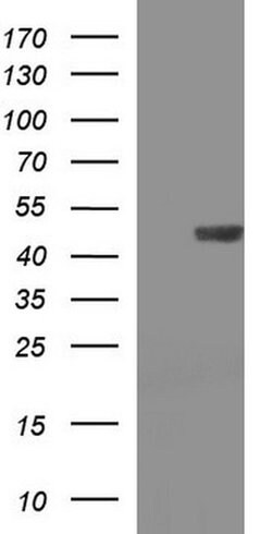 TXNDC5 Monoclonal Antibody (OTI2F6), TrueMAB , OriGene 100 &mu;L; Unconjugated:Antibodies,