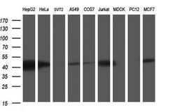 TXNDC5 Monoclonal Antibody (OTI2F6), TrueMAB , OriGene 100 &mu;L; Unconjugated:Antibodies,