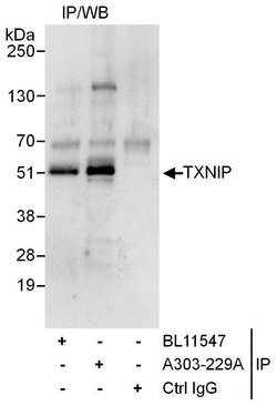 TXNIP Rabbit anti-Human, Polyclonal, Bethyl Laboratories 10 &mu;L; Unconjugated:Antibodies,