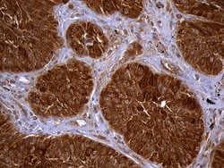 TXNRD1 Monoclonal Antibody (OTI7B2), TrueMAB , OriGene 100 &mu;L; Unconjugated:Antibodies,
