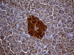 TXNRD1 Monoclonal Antibody (OTI7B2), TrueMAB , OriGene 100 &mu;L; Unconjugated:Antibodies,