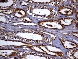 TXNRD1 Monoclonal Antibody (OTI7B2), TrueMAB , OriGene 100 &mu;L; Unconjugated:Antibodies,