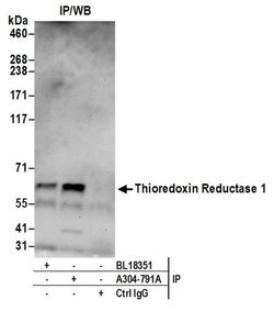 Thioredoxin Reductase 1/TXNRD1/TRXR1 Rabbit anti-Human, Polyclonal, Bethyl