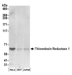 Thioredoxin Reductase 1/TXNRD1/TRXR1 Rabbit anti-Human, Polyclonal, Bethyl