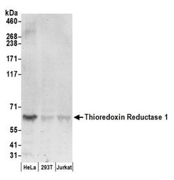 Thioredoxin Reductase 1/TXNRD1/TRXR1 Polyclonal Antibody, Bethyl Laboratories:Antibodies:Primary