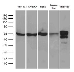 TXNRD1 Monoclonal Antibody (OTI3E1), TrueMAB , OriGene 100 &mu;L; Unconjugated:Antibodies,