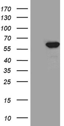TXNRD1 Monoclonal Antibody (OTI5G3), TrueMAB , OriGene 100 &mu;L; Unconjugated:Antibodies,