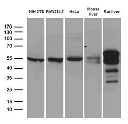 TXNRD1 Monoclonal Antibody (OTI5G3), TrueMAB , OriGene 100 &mu;L; Unconjugated:Antibodies,