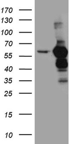 TXNRD1 Monoclonal Antibody (OTI7B2), TrueMAB , OriGene 100 &mu;L; Unconjugated:Antibodies,
