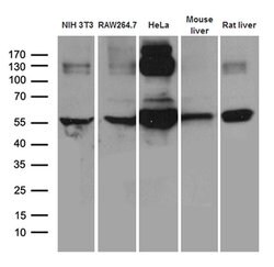 TXNRD1 Monoclonal Antibody (OTI7B2), TrueMAB , OriGene 100 &mu;L; Unconjugated:Antibodies,