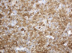 TYMP Mouse anti-Human, Clone: OTI1E7, liquid, TrueMAB 100 &mu;L; Unconjugated:Antibodies,