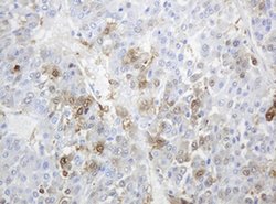TYMP Mouse anti-Human, Clone: OTI1E7, liquid, TrueMAB 100 &mu;L; Unconjugated:Antibodies,