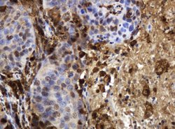 TYMP Mouse anti-Human, Clone: OTI1H7, lyophilized, TrueMAB 100 &mu;g; Unconjugated:Antibodies,
