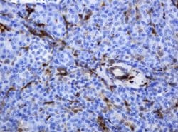 TYMP Monoclonal Antibody (OTI1H7), TrueMAB , OriGene:Antibodies:Primary