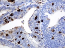 TYMP Mouse anti-Human, Clone: OTI1H7, lyophilized, TrueMAB 100 &mu;g; Unconjugated:Antibodies,