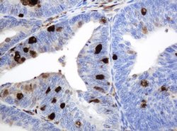 TYMP Monoclonal Antibody (OTI1H7), TrueMAB , OriGene 100 &mu;L; Unconjugated:Antibodies,