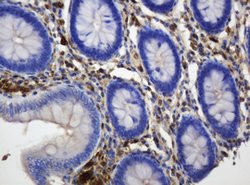 TYMP Mouse anti-Human, Clone: OTI1H7, lyophilized, TrueMAB 100 &mu;g; Unconjugated:Antibodies,