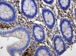 TYMP Monoclonal Antibody (OTI1H7), TrueMAB , OriGene 100 &mu;L; Unconjugated:Antibodies,