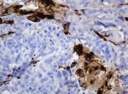 TYMP Monoclonal Antibody (OTI1H7), TrueMAB , OriGene 100 &mu;L; Unconjugated:Antibodies,