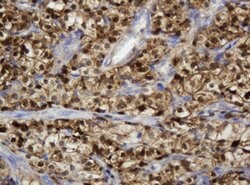 TYMP Mouse anti-Human, Clone: OTI1H7, lyophilized, TrueMAB 100 &mu;g; Unconjugated:Antibodies,