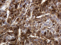 TYMP Mouse anti-Human, Clone: OTI1H7, lyophilized, TrueMAB 100 &mu;g; Unconjugated:Antibodies,