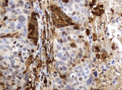 TYMP Mouse anti-Human, Clone: OTI7A6, lyophilized, TrueMAB 100 &mu;g; Unconjugated:Antibodies,