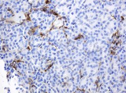 TYMP Monoclonal Antibody (OTI7A6), TrueMAB , OriGene 30 &mu;L; Unconjugated:Antibodies,