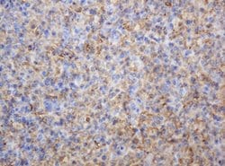 TYMP Mouse anti-Human, Clone: OTI7A6, lyophilized, TrueMAB 100 &mu;g; Unconjugated:Antibodies,