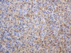 TYMP Monoclonal Antibody (OTI7A6), TrueMAB , OriGene 30 &mu;L; Unconjugated:Antibodies,