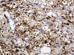 TYMP Mouse anti-Human, Clone: OTI7A6, lyophilized, TrueMAB 100 &mu;g; Unconjugated:Antibodies,