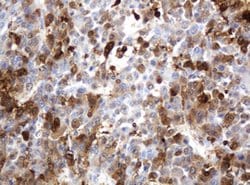 TYMP Mouse anti-Human, Clone: OTI7A6, lyophilized, TrueMAB 100 &mu;g; Unconjugated:Antibodies,